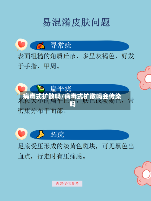 病毒式扩散吗/病毒式扩散吗会传染吗